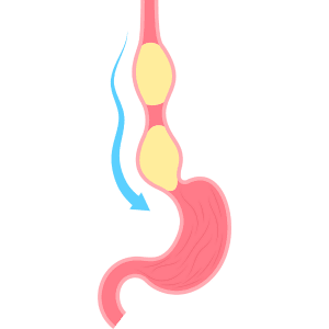 Esophagus